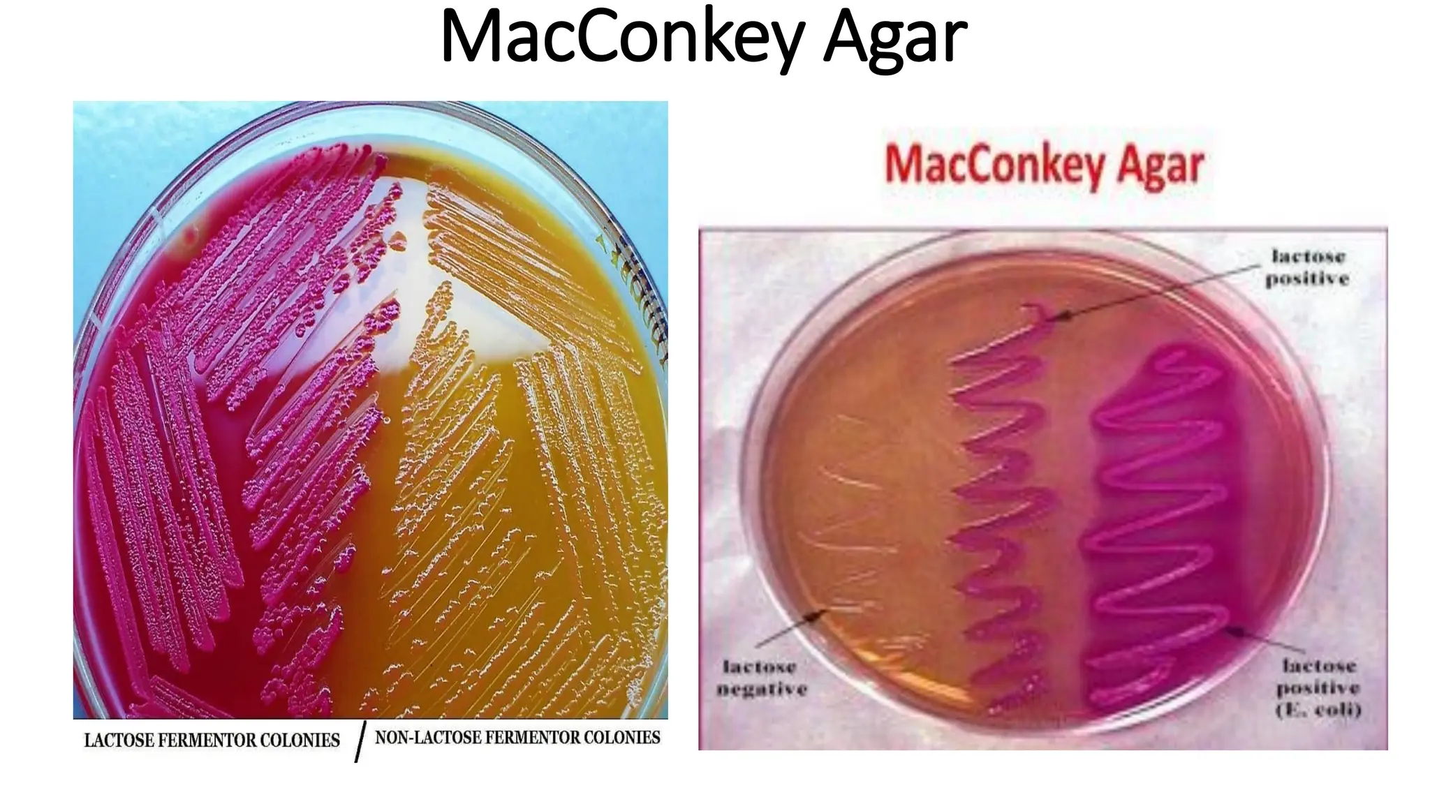 MacConkey Agar
 