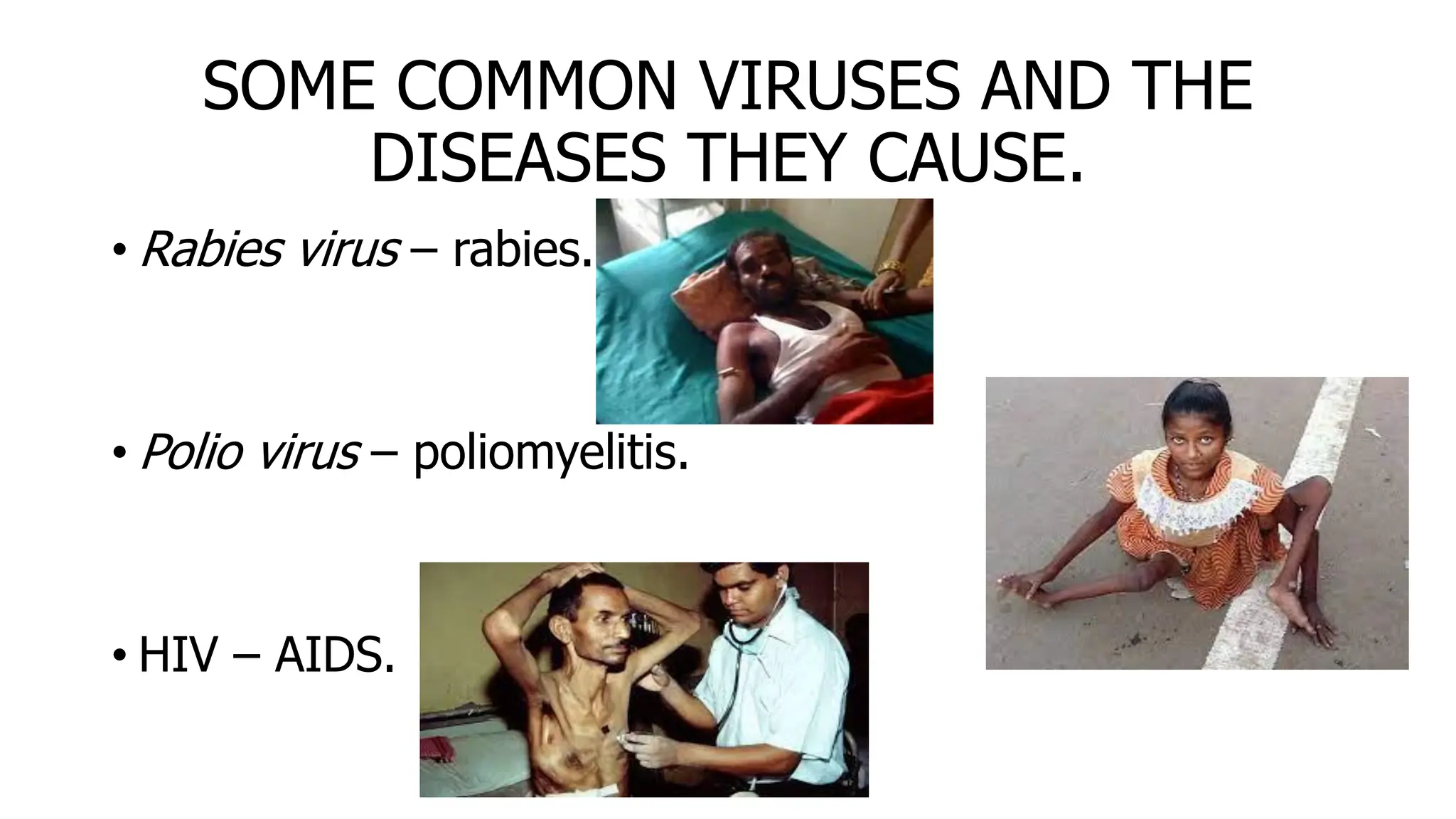 SOME COMMON VIRUSES AND THE
DISEASES THEY CAUSE.
• Rabies virus – rabies.
• Polio virus – poliomyelitis.
• HIV – AIDS.
 