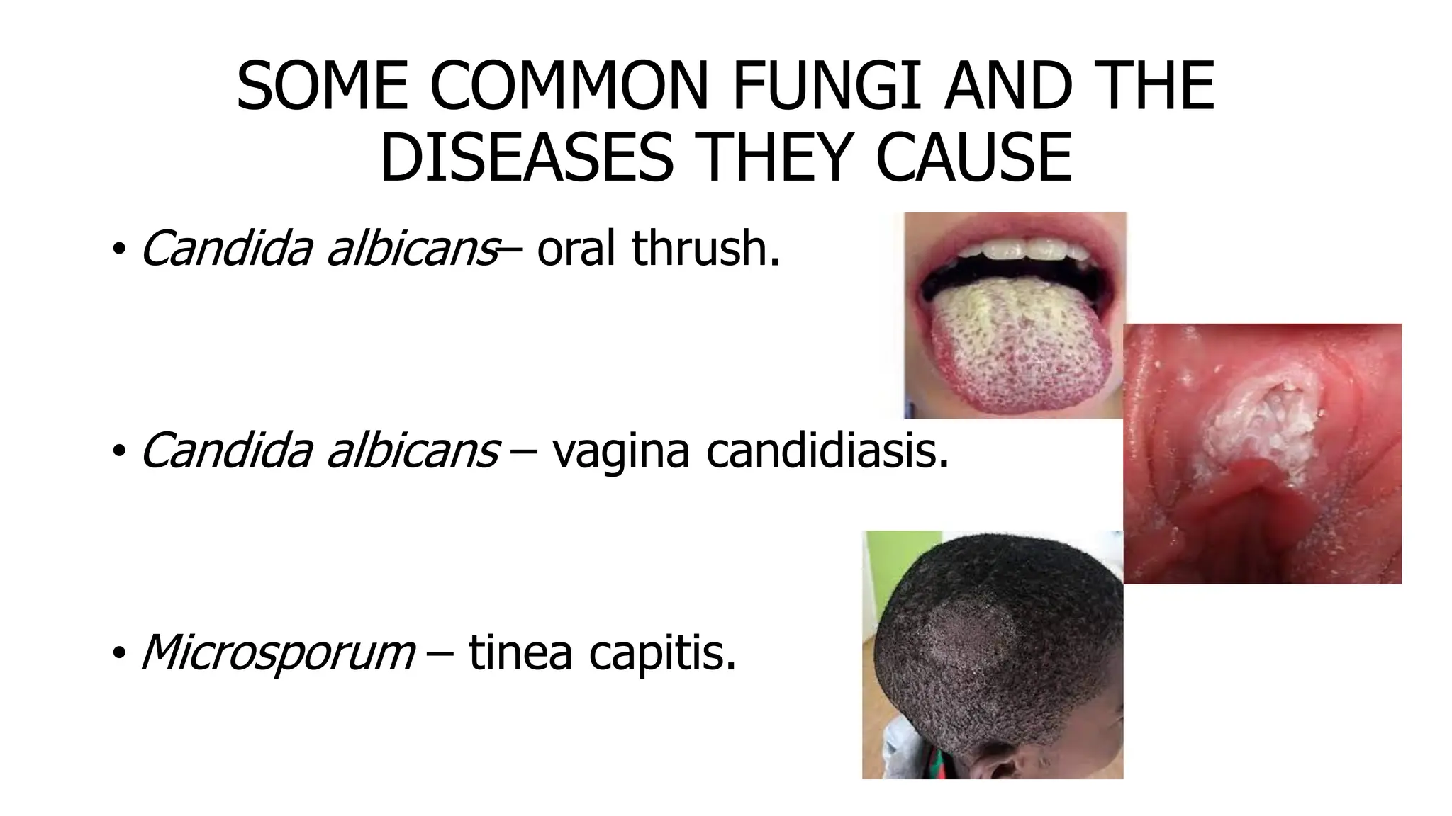 SOME COMMON FUNGI AND THE
DISEASES THEY CAUSE
• Candida albicans– oral thrush.
• Candida albicans – vagina candidiasis.
• Microsporum – tinea capitis.
 