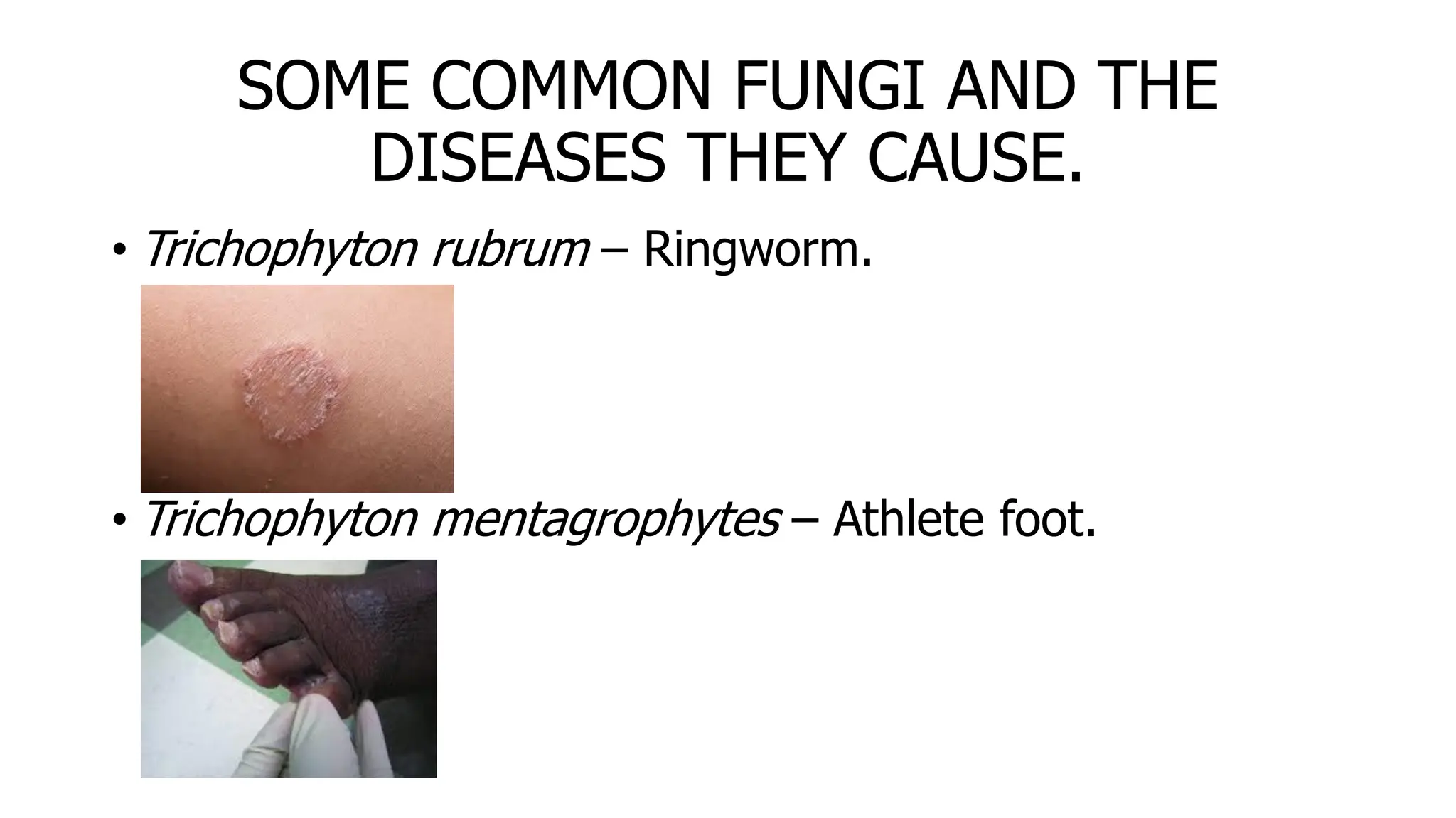 SOME COMMON FUNGI AND THE
DISEASES THEY CAUSE.
• Trichophyton rubrum – Ringworm.
• Trichophyton mentagrophytes – Athlete foot.
 