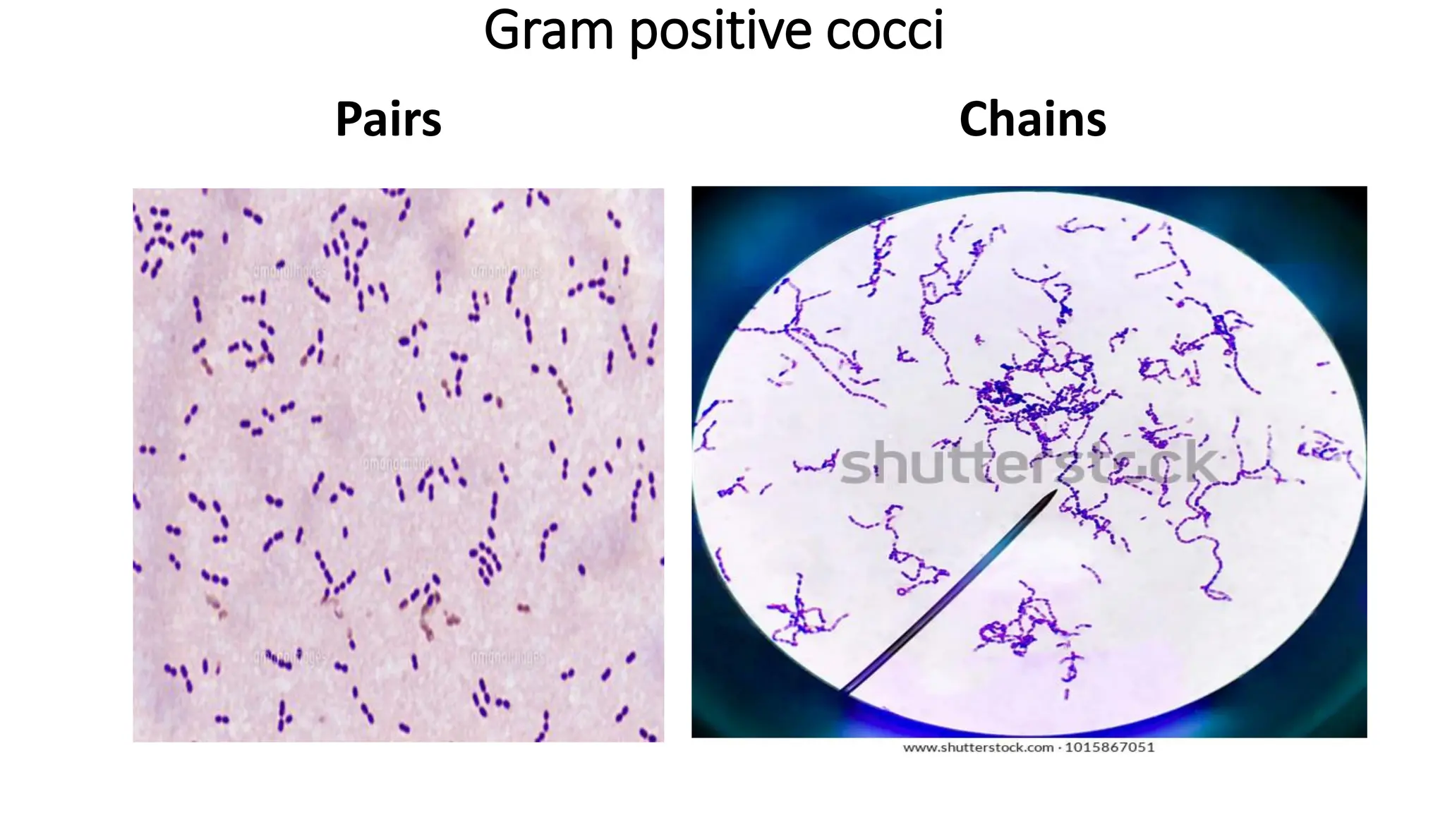 Gram positive cocci
Pairs Chains
 
