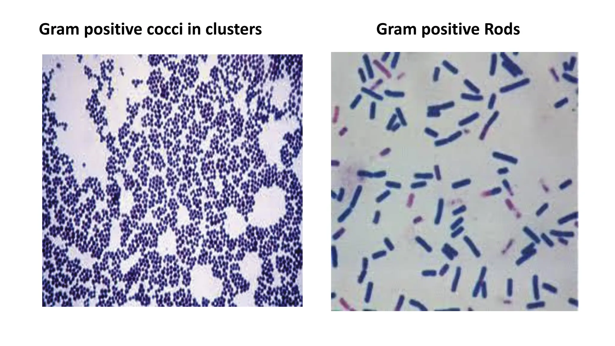 Gram positive cocci in clusters Gram positive Rods
 