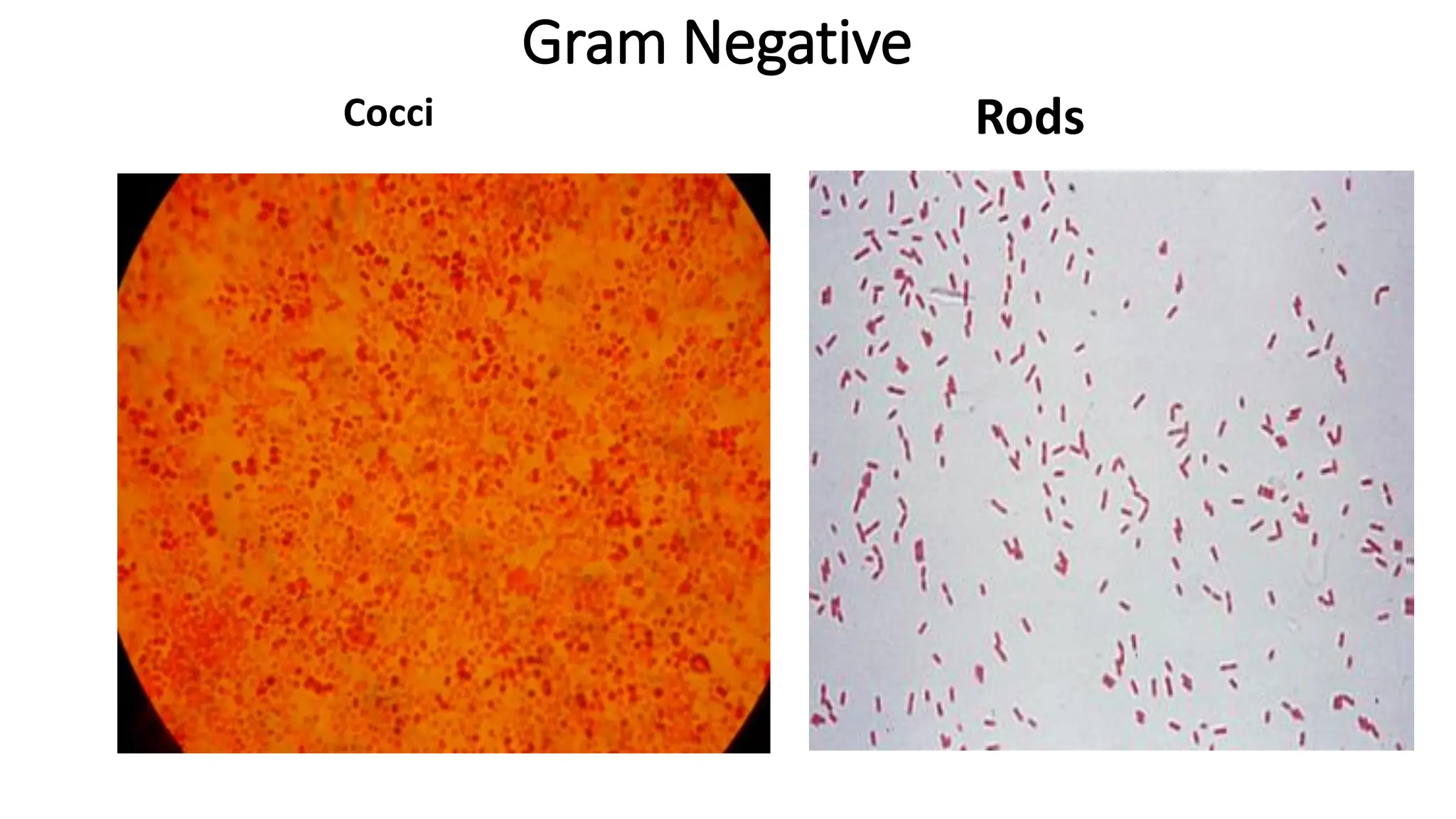 Gram Negative
Cocci Rods
 