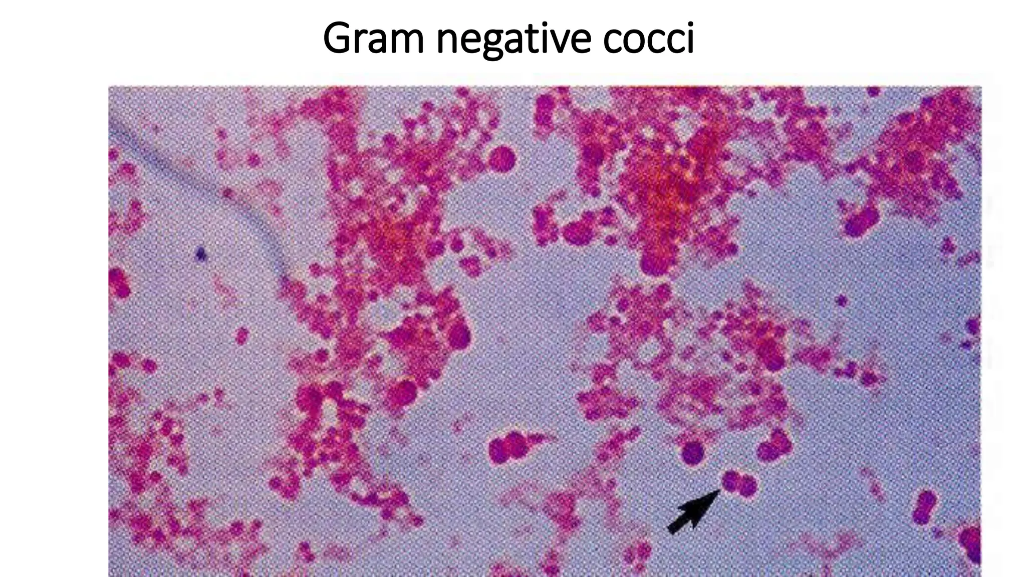 Gram negative cocci
 