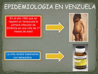 EPIDEMIOLOGIA EN VENZUELA
En el año 1992 que se
registró en Venezuela la
primera infección de
Ehrlichia en una niña de 17
meses de edad
La niña recibió tratamiento
con tetraciclina
 