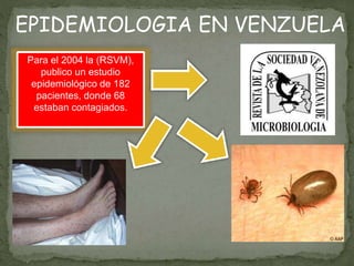 Para el 2004 la (RSVM),
publico un estudio
epidemiológico de 182
pacientes, donde 68
estaban contagiados.
EPIDEMIOLOGIA EN VENZUELA
 