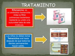 Rifampicina: es
un antibiótico bactericida. i
nhibe la RNA
polimerasa bacteriana
mediante su unión a la
subunidad beta de esta
molécula.
Los niños no deben tomar
Tetraciclina oral hasta
después de que todos los
dientes permanentes
hayan salido.
TRATAMIENTO
 