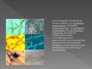 Microfotografías de diferentes hongos aislados. (A) Scytalidium thermophilum; (B) Posible Acremonium sp.; (C) Scytalidium acidophilum; (D) Lecythophora hoffmannii; (E) Cepa de clasificación incierta caracterizada por la pigmentación oscura de las hifas y la formación de incipientes esclerocios; (F) Imagen de la alta densidad de hifas de hongos encontradas.