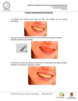 Utilización de Software de Diseño para el manejo de Graficos-303
                                                             Ing. René Domínguez Escalona
                                                                 Karla Gabriela Bernal Sixto.
                                                                                 Photoshop

                    Practica 1:Blanqueamiento de Dientes.



Lo primero que tenemos que hacer es abrir una imagen de una sonrisa
amarillenta.




Después con la herramienta pincel y con la herramienta de editar en Modo
estándar pintaremos los dientes.




Al terminar de pintar los dientes le damos clic a la herramienta de editar de Modo
estándar y nos iremos a selección e invertir.




CECYTEM Tecámac- Técnico en informática       5-Diciembre-2012
 