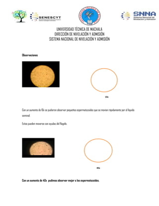UNIVERSIDAD TÉCNICA DE MACHALA
DIRECCIÓN DE NIVELACIÓN Y ADMISIÓN
SISTEMA NACIONAL DE NIVELACIÓN Y ADMISIÓN

Observaciones

10x

Con un aumento de 10x se pudieron observar pequeños espermatozoides que se movían rápidamente por el líquido
seminal.
Estos pueden moverse con ayudas del flagelo.

40x

Con un aumento de 40x pudimos observar mejor a los espermatozoides.

 