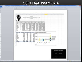 SEPTIMA PRACTICA