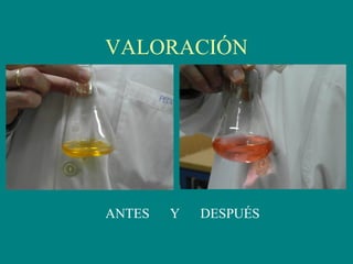 VALORACIÓN
ANTES Y DESPUÉS
 