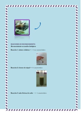 REACCIONES DE RECONOCIMIENTO:

Reconocimiento en medios biológicos
Reacción 1: nitrato cobaltoso = ( +) no caracterisitico

Reacción 2: cloruro de níquel = (+) característico

Reacción 3: sales férricas de sodio = ( + ) característico

 