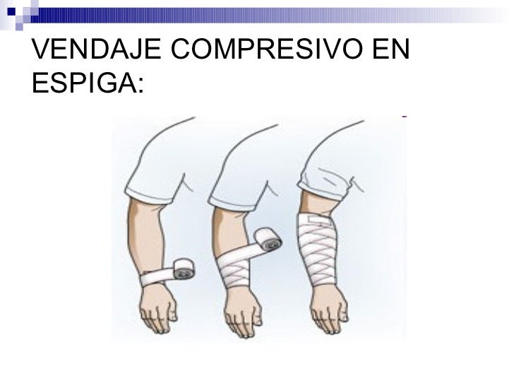 Resultado de imagen para tipos de vendajes compresivos