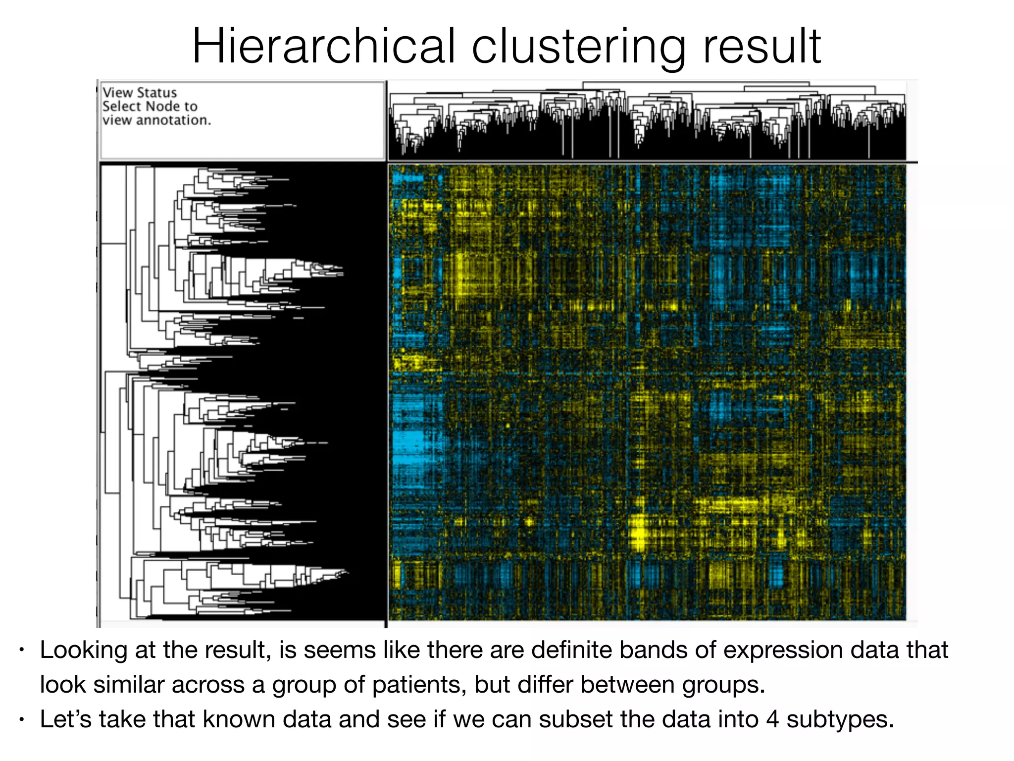 • Looking at the result, is seems like there are deﬁnite bands of expression data that
look similar across a group of patients, but diﬀer between groups. 

• Let’s take that known data and see if we can subset the data into 4 subtypes.
Hierarchical clustering result
 