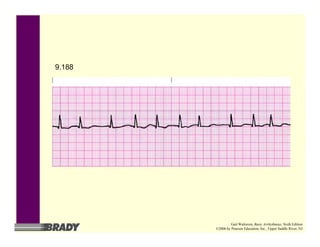 9.188
Gail Walraven, Basic Arrhythmias, Sixth Edition
©2006 by Pearson Education, Inc., Upper Saddle River, NJ
 