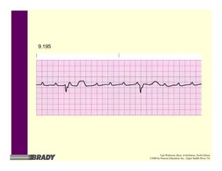 9.195
Gail Walraven, Basic Arrhythmias, Sixth Edition
©2006 by Pearson Education, Inc., Upper Saddle River, NJ
 
