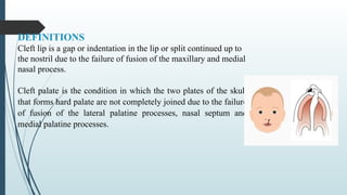 PRACTICE TEACHING ON –Cleft lip & cleft.pptx gastrointerstinal | PPTX