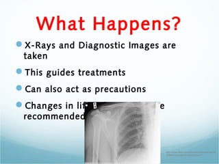 What Happens?
X-Rays and Diagnostic Images are
 taken
This guides treatments
Can also act as precautions
Changes in lifestyle can also be
 recommended


                                    http://www.flickr.com/photos/adrianrbarnes/22
                                    2098051/sizes/m/in/photostream/
 