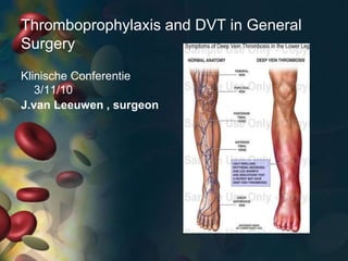 Thromboprophylaxis and DVT in General
Surgery
J.van Leeuwen , surgeon
Klinische Conferentie
3/11/10
 
