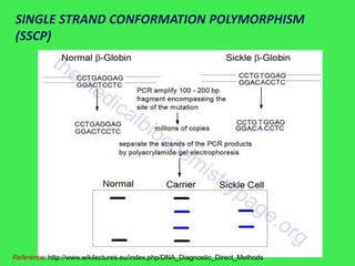 SINGLE STRAND CONFORMATION POLYMORPHISM
(SSCP)




Reference: http://www.wikilectures.eu/index.php/DNA_Diagnostic_Direct_Methods
 