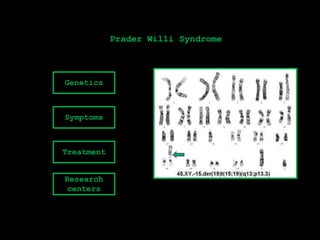 Prader Willi Syndrome



Genetics



Symptoms



Treatment


Research
 centers
 