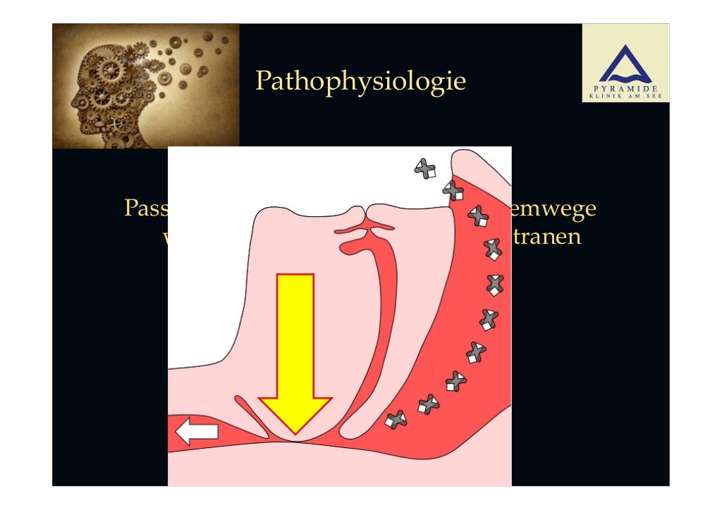 Obstruktives Schlafapnoe-Syndrom (OSAS): Dr. med. Daniel Brusco des Z…