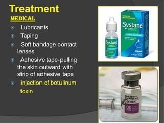 Treatment
MEDICAL
 Lubricants
 Taping
 Soft bandage contact
lenses
 Adhesive tape-pulling
the skin outward with
strip of adhesive tape
 injection of botulinum
toxin
 