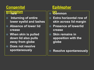  rare
 Inturning of entire
lower eyelid and lashes
 Absence of lower lid
crease
 When skin is pulled
down lid also pulls
away from globe
 Does not resolve
spontaneously
 Common
 Extra horizontal row of
skin across lid margin
 Presence of lowerlid
crease
 Skin remains in
apposition with the
globe
 Resolve spontaneously
Congenital
entropion
Epiblephar
on
 