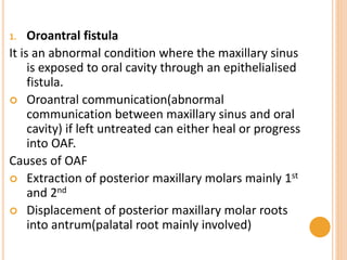 1. Oroantral fistula
It is an abnormal condition where the maxillary sinus
is exposed to oral cavity through an epithelialised
fistula.
 Oroantral communication(abnormal
communication between maxillary sinus and oral
cavity) if left untreated can either heal or progress
into OAF.
Causes of OAF
 Extraction of posterior maxillary molars mainly 1st
and 2nd
 Displacement of posterior maxillary molar roots
into antrum(palatal root mainly involved)
 