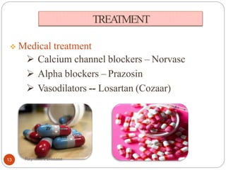 TREATMENT
 Medical treatment
 Calcium channel blockers – Norvasc
 Alpha blockers – Prazosin
 Vasodilators -- Losartan (Cozaar)
13 Raynaud's Disease
 