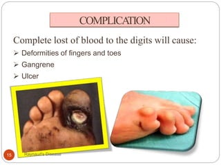COMPLICATION
Complete lost of blood to the digits will cause:
 Deformities of fingers and toes
 Gangrene
 Ulcer
15 Raynaud's Disease
 