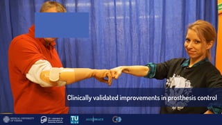 Clinically validated improvements in prosthesis control
