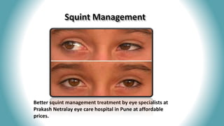 Better squint management treatment by eye specialists at
Prakash Netralay eye care hospital in Pune at affordable
prices.
 