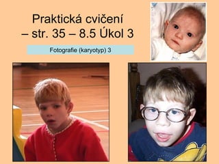 Praktick cvi?en C str. 35 C 8.5 ?kol 3 Fotografie (karyotyp) 3 