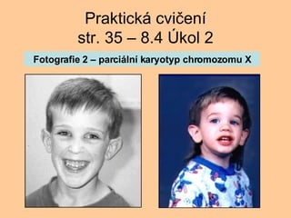 Praktick cvi?en str. 35 C 8.4 ?kol 2 Fotografie 2 C parciln karyotyp chromozomu X 