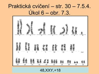 Praktick cvi?en C str. 30 C 7.5.4. ?kol 6 C obr. 7.3. 48,XXY,+18 