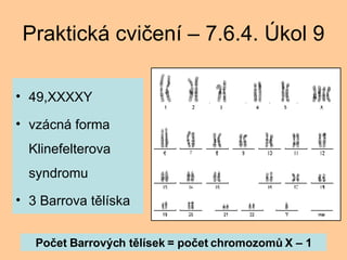 Praktick cvi?en C 7.6.4. ?kol 9 49,XXXXY vzcn forma Klinefelterova syndromu 3 Barrova tlska Po?et Barrov?ch tlsek = po?et chromozom? X C 1 
