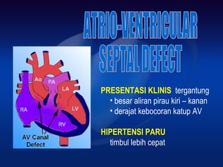 PRESENTASI KLINIS tergantung
• besar aliran pirau kiri – kanan
• derajat kebocoran katup AV
HIPERTENSI PARU
timbul lebih cepat
 