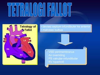 • deviasi septum infundibuler ke anterior
• malrotasi bulbus
• deviasi septum infundibuler ke anterior
• malrotasi bulbus
VSD perimembranus
Ao overriding
PS valvular-infundibular
RV hipertrofi
VSD perimembranus
Ao overriding
PS valvular-infundibular
RV hipertrofi
 