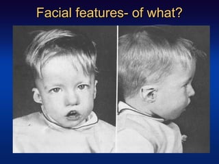 Facial features- of what?Facial features- of what?
 