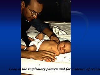 Look at the respiratory pattern and for evidence of recess
 