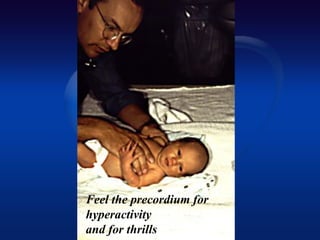Feel the precordium for
hyperactivity
and for thrills
 