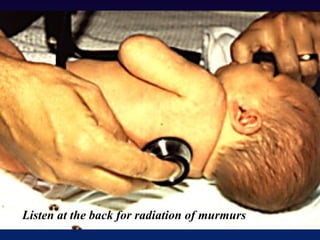 Listen at the back for radiation of murmurs
 