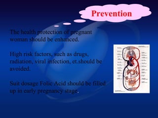 Prevention
The health protection of pregnant
woman should be enhanced.
High risk factors, such as drugs,
radiation, viral infection, et.should be
avoided.
Suit dosage Folic Acid should be filled
up in early pregnancy stage.
 