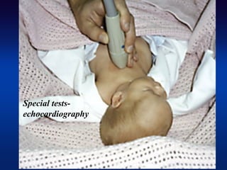 Special tests-
echocardiography
 