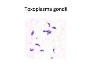 Toxoplasma gondii
 