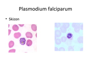 Plasmodium falciparum
• Skizon
 