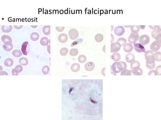 Plasmodium falciparum
• Gametosit
 
