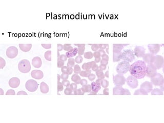 Plasmodium vivax
• Tropozoit (ring form)   Amuboid
 